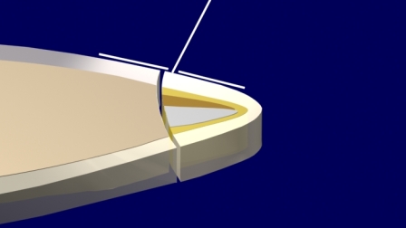 Figura 27: El esmalte difusor guia haces de luz hacia el esmalte adyacente. 